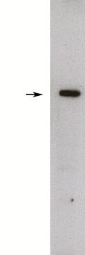 " 
Western blot of rat kidney lysate (10 ug/lane), detection of endogenous Sphingosine kinase 1, long form using X1848P (1 ug/ml), HRP anti-rabbit was used at 1:75k, and developed with Pierce’s Super Signal West Femto. "
